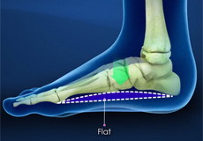 Pediatric Foot Conditions